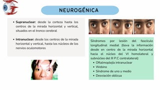 Supranuclear: desde la corteza hasta los
centros de la mirada horizontal y vertical,
situados en el tronco cerebral
Intranuclear: desde los centros de la mirada
horizontal y vertical, hasta los núcleos de los
nervios oculomotores
Síndromes por lesión del fascículo
longitudinal medial (lleva la información
desde en centro de la mirada horizontal
hacia el núcleo del VI homolateral y
subnúcleo del III P.C contralateral)
Oftalmoplejía intranuclear
Webino
Síndrome de uno y medio
Desviación oblicua
 
