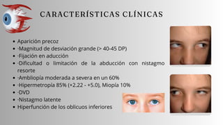 Aparición precoz
·Magnitud de desviación grande (> 40-45 DP)
·Fijación en aducción
·Dificultad o limitación de la abducción con nistagmo
resorte
·Ambliopía moderada a severa en un 60%
·Hipermetropía 85% (+2.22 - +5.0), Miopía 10%
·DVD
·Nistagmo latente
Hiperfunción de los oblicuos inferiores
 