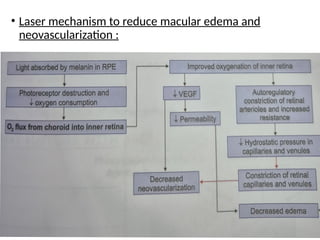 • Laser mechanism to reduce macular edema and
neovascularization :
 