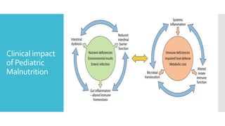 Malnutrition in Children: A Major Threat to the Under Nourished ...