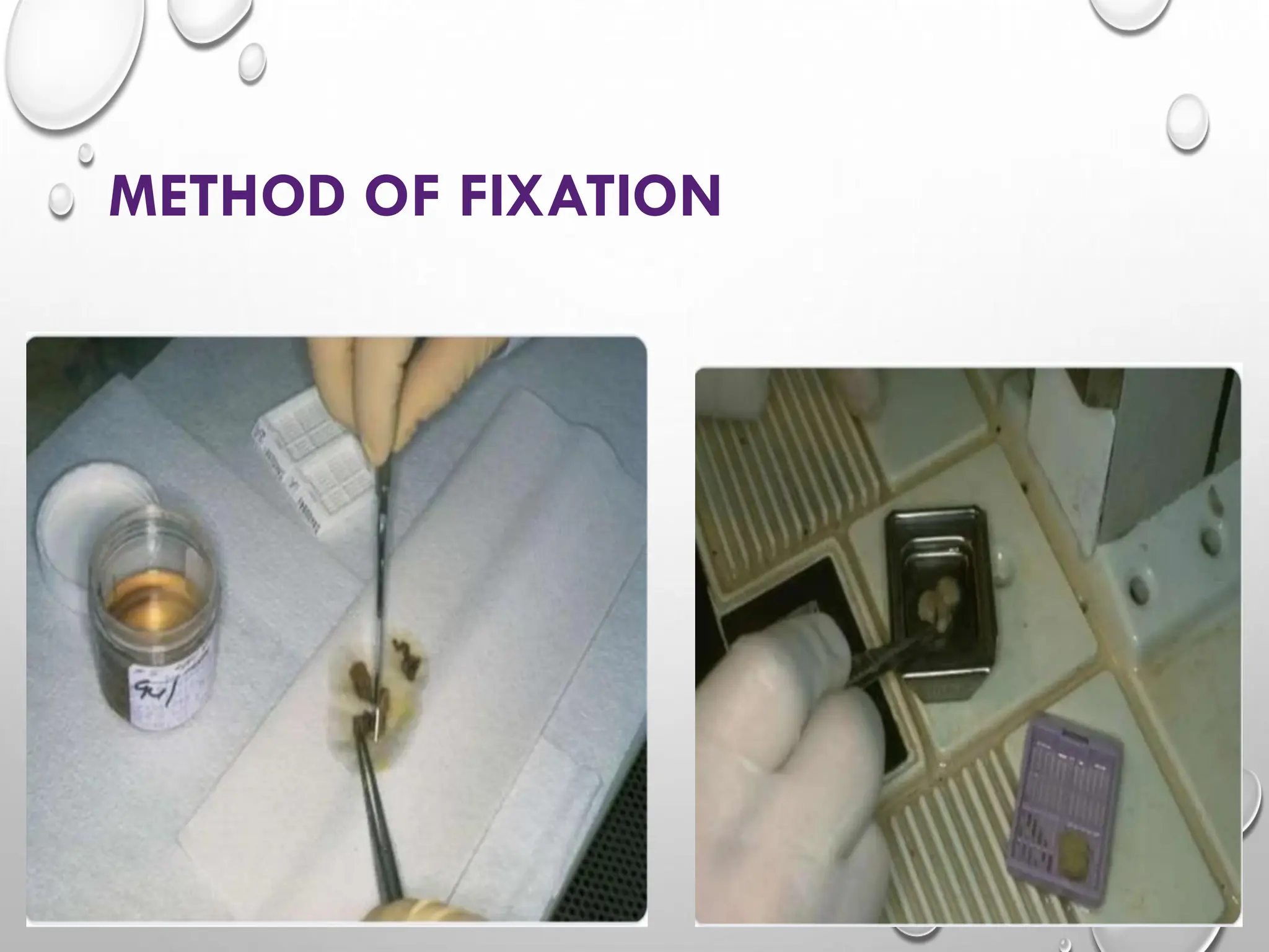 METHOD OF FIXATION
 