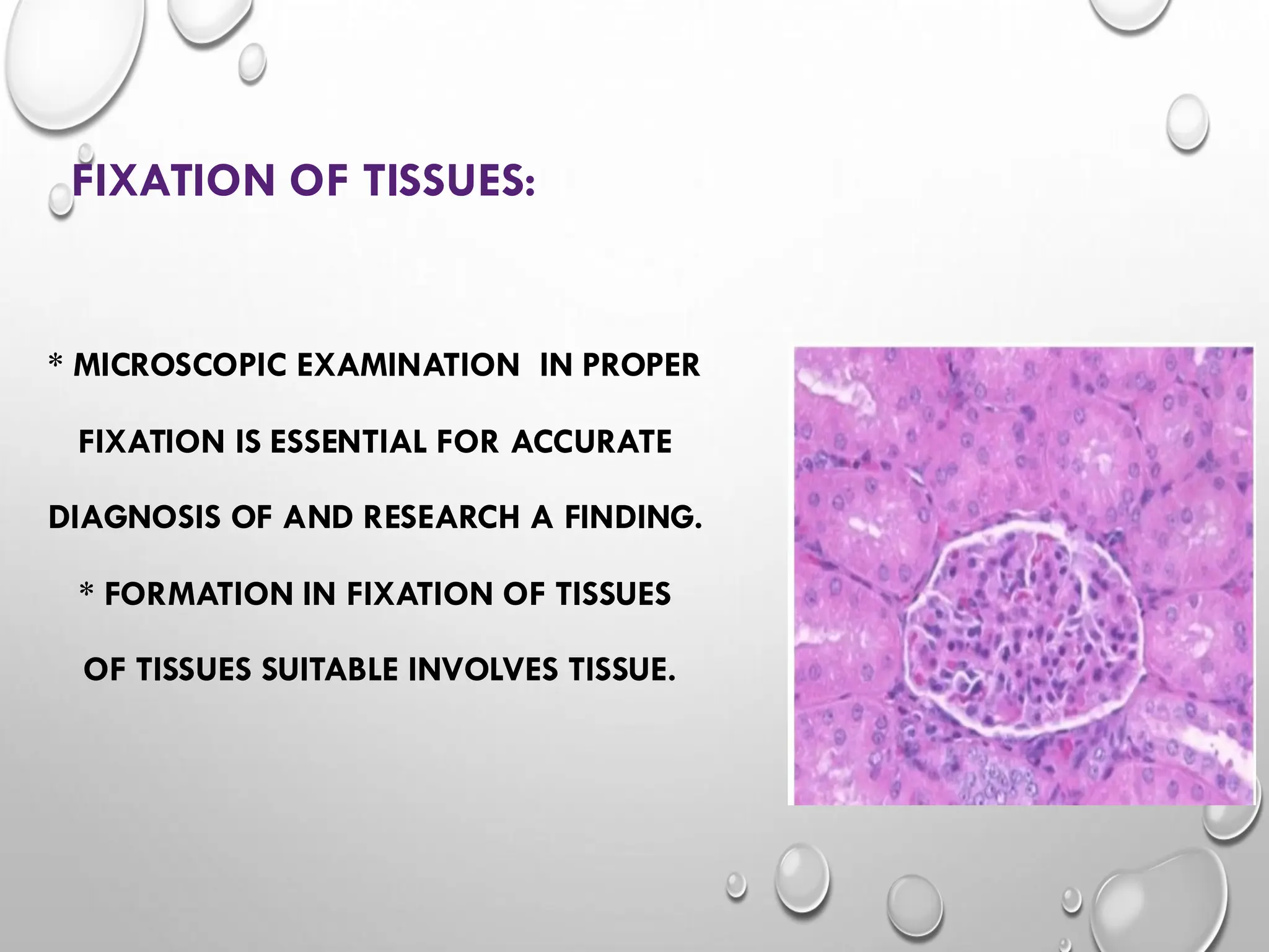 * MICROSCOPIC EXAMINATION IN PROPER
FIXATION IS ESSENTIAL FOR ACCURATE
DIAGNOSIS OF AND RESEARCH A FINDING.
* FORMATION IN FIXATION OF TISSUES
OF TISSUES SUITABLE INVOLVES TISSUE.
FIXATION OF TISSUES:
 