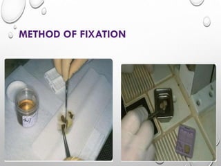HISTOPATHOLOGY FIXATION OF TISSUES CLASSIFICATION AND PROPERTIES OF ...