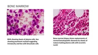 Normal Marrow Elements DOC-20241023-WA0150..................pptx