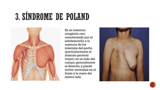 deformidades-toracicas-con-relaci-n-a-pediatria-pptx