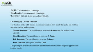 UNDERSTANDING PTOSIS:CAUSES,CLASSIFICATION, DIAGNOSIS, AND TREATMENT.pptx
