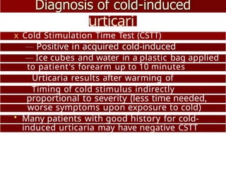 Cold Simulation Test Positive URTICARIA AND ANGIOEDEMA ANA ITS CAUSES AND TYPES | PPTX