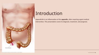 Appendicitis ppt for university DOc .pptx