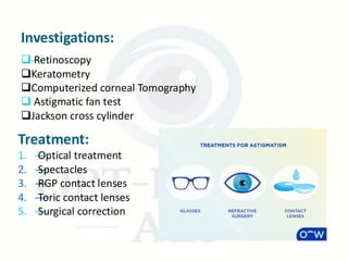 Astigmatism – Types, Causes, and Management | PDF