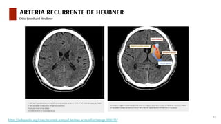 Revisión de tema: epónimos es neurocirugía vascular | PDF