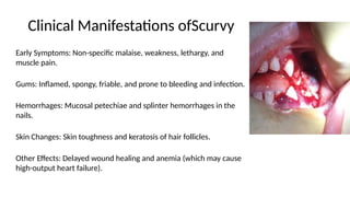 Splinter Inflamed Comprehensive Overview of Common Vitamin Deficiencies: Causes, Symptoms ...