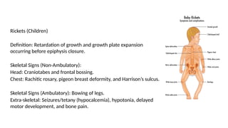 Rickets Overview Comprehensive Overview of Common Vitamin Deficiencies: Causes, Symptoms ...