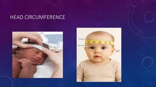 HEAD CIRCUMFERENCE
 