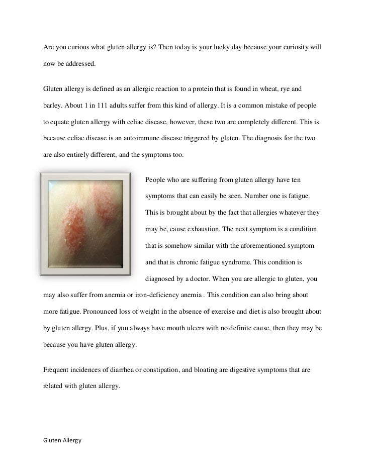 Adults And Their Gluten Allergy Symptoms