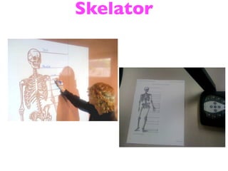 Skelator
 