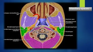 Maxillary spaces
 