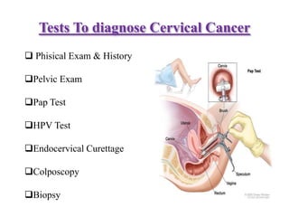 Tests To diagnose Cervical Cancer
 Phisical Exam & History
Pelvic Exam
Pap Test
HPV Test
Endocervical Curettage
Colposcopy
Biopsy
 