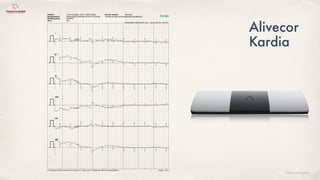 ©lucienengelen
Alivecor
Patiënt:: Lucien Engelen, 02-07-1962 (57jaar)
Geregistreerd: woensdag 6 november 2019 om 16:24:48
Hartfrequentie: 85 BPM
Duur: 30s
Directe analyse: Normaal
*Directe analyse wordt uitgevoerd bij afleiding I.
Standaardfilter, Netfrequentie: 60Hz Schaal: 25mm/s, 10mm/mV
(c) Copyright 2012-2018, AliveCor Inc, Kardia v5.7.2.1603, UUID: 135dbf35-cdd7-45da-917a-6cc0cd498c10 Pagina 1 van 4
I
II
III
aVR
aVL
aVF
Kardia
 