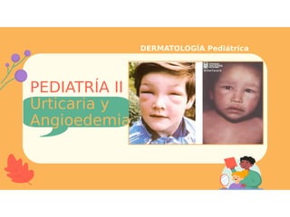 PEDIATRÍA II
Urticaria y
Angioedemia
DERMATOLOGÍA Pediátrica
 