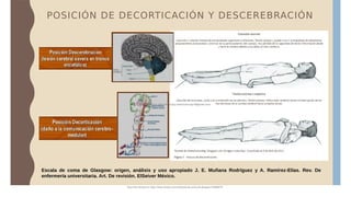 POSICIÓN DE DECORTICACIÓN Y DESCEREBRACIÓN
Escala de coma de Glasgow: origen, análisis y uso apropiado J. E. Muñana Rodríguez y A. Ramírez-Elías. Rev. De
enfermería universitaria. Art. De revisión. ElSeiver México.
Document shared on https://www.docsity.com/es/escala-de-coma-de-glasgow-2/5588072/
Downloaded by: elian-chancusig (elianchancusig18@gmail.com)
 