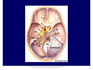 Document shared on https://www.docsity.com/es/hematoma-subdural-panorama-general/5322403/
Downloaded by: jennifer-fernandez-vizcarra (j_enn29@hotmail.com)
 