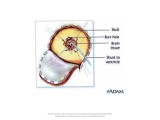 Document shared on https://www.docsity.com/es/hematoma-subdural-panorama-general/5322403/
Downloaded by: jennifer-fernandez-vizcarra (j_enn29@hotmail.com)
 