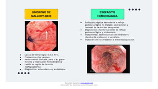 SÍNDROME DE
MALLORY-WEIS
● Causa de hemorragia: 0,5 al 17%.
● Frecuente en los varones.
● Hematemesis limitada, pero si es grave:
melena y repercusión hemodinámica
● Lesión en región de la unión
esofagogástrica
● Diagnóstico: antecedentes y endoscopía.
ESOFAGITIS
HEMORRAGICA
●
●
●
Esofagitis péptica secundaria a reflujo
gastroesofágico no tratada: ulceraciones y
lesiones de la mucosa sangrantes.
● Diagnóstico: manifestaciones de reflujo
gastroesofágico y endoscopía.
Tratamiento: Administración de inhibidores
(bomba de protones ) o sucralfato.
Inyección de esclerosantes o electrocoagulación.
Document shared on www.docsity.com
Downloaded by: JesusAriza (jariza2394@gmail.com)
 