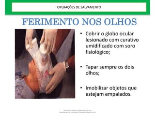 FERIMENTO NOS OLHOS
• Cobrir o globo ocular
lesionado com curativo
umidificado com soro
fisiológico;
• Tapar sempre os dois
olhos;
• Imobilizar objetos que
estejam empalados.
OPERAÇÕES DE SALVAMENTO
Document shared on www.docsity.com
Downloaded by: leal-safety (lealsafety@gmail.com)
 