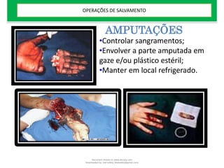 AMPUTAÇÕES
•Controlar sangramentos;
•Envolver a parte amputada em
gaze e/ou plástico estéril;
•Manter em local refrigerado.
OPERAÇÕES DE SALVAMENTO
Document shared on www.docsity.com
Downloaded by: leal-safety (lealsafety@gmail.com)
 