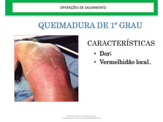 QUEIMADURA DE 1º GRAU
• Dor;
• Vermelhidão local.
CARACTERÍSTICAS:
OPERAÇÕES DE SALVAMENTO
Document shared on www.docsity.com
Downloaded by: leal-safety (lealsafety@gmail.com)
 