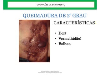 QUEIMADURA DE 2º GRAU
• Dor;
• Vermelhidão;
• Bolhas.
CARACTERÍSTICAS:
OPERAÇÕES DE SALVAMENTO
Document shared on www.docsity.com
Downloaded by: leal-safety (lealsafety@gmail.com)
 