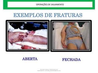 EXEMPLOS DE FRATURAS
ABERTA FECHADA
OPERAÇÕES DE SALVAMENTO
Document shared on www.docsity.com
Downloaded by: leal-safety (lealsafety@gmail.com)
 