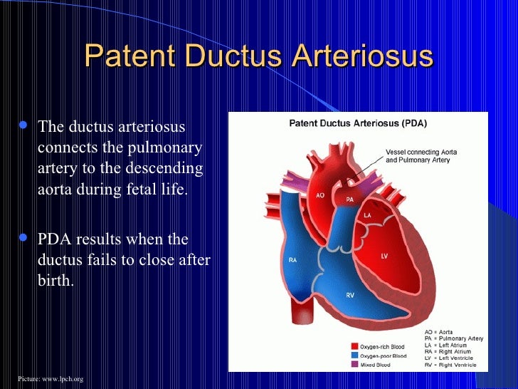 Docslide:congenital heart disease