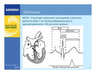 19
Siemens no Brasil
2005
Definições
NOTA - O período vulnerável corresponde à primeira
parte da onda T no eletrocardiograma que é
aproximadamente 10% do ciclo cardíaco.
 