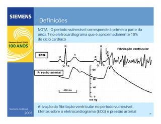 20
Siemens no Brasil
2005
Definições
NOTA - O período vulnerável corresponde à primeira parte da
onda T no eletrocardiograma que é aproximadamente 10%
do ciclo cardíaco
Ativação da fibrilação ventricular no período vulnerável.
Efeitos sobre o eletrocardiograma (ECG) e pressão arterial
 
