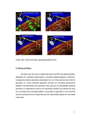 APÓS RECUPERAÇÃO DA PÓLIO            SÍNDROME PÓS-PÓLIO




         SÍNDROME PÓS-PÓLIO
                                                  SÍNDROME PÓS-PÓLIO




Fonte: http: //www.Post.Polio.org/cd/patho/patho5.html


RECUPERAÇÃO DA

6. Fatores de Risco


       Os fatores de risco para o desenvolvimento da SPP são desconhecidos.
Baseados em repetidas observações e inquéritos epidemiológicos, entretanto,
os seguintes fatores aparecem associados com um início precoce da síndrome
pós-polio: (1) novos sintomas aparecem primeiro em membros previamente
lesados e em pacientes com paralisias mais severas; (2) dificuldades bulbares
precoces ou respiratórias ocorrem em pacientes residual com perdas de força
em musculatura de inervação bulbar e musculatura respiratória; e (3) sintomas
ocorrem precocemente em pacientes que tem poliomielite aguda em uma idade
mais tarde.




                                                                           12
 
