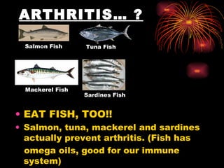 ARTHRITIS… ?   EAT FISH, TOO!!  Salmon, tuna, mackerel and sardines actually prevent arthritis. (Fish has omega oils, good for our immune system) Salmon Fish Tuna Fish Mackerel Fish Sardines Fish 