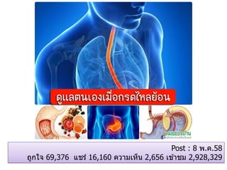 Post : 8 พ.ค.58
ถูกใจ 69,376 แชร์ 16,160 ความเห็น 2,656 เข ้าชม 2,928,329
 