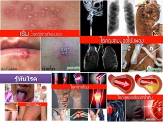รู้ทันโรค
 