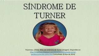 Trisomiass, (2014). Niña con síndrome de Turner. [imagen]. Disponible en: 
http://trisomiass.blogspot.com/2014/03/sindromede-turner-tambienconocido- 
como.html [consultado 28 Nov de 2014] 
 
