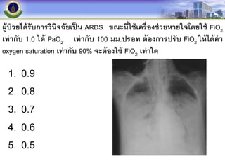 ผู้ป่วยได้รับการวินิจฉัยเป็น ARDS ขณะนี้ใช้เครื่องช่วยหายใจโดยใช้ FiO2
เท่ากับ 1.0 ได้ PaO2 เท่ากับ 100 มม.ปรอท ต้องการปรับ FiO2 ให้ได้ค่า
oxygen saturation เท่ากับ 90% จะต้องใช้ FiO2 เท่าใด
1. 0.9
2. 0.8
3. 0.7
4. 0.6
5. 0.5
 