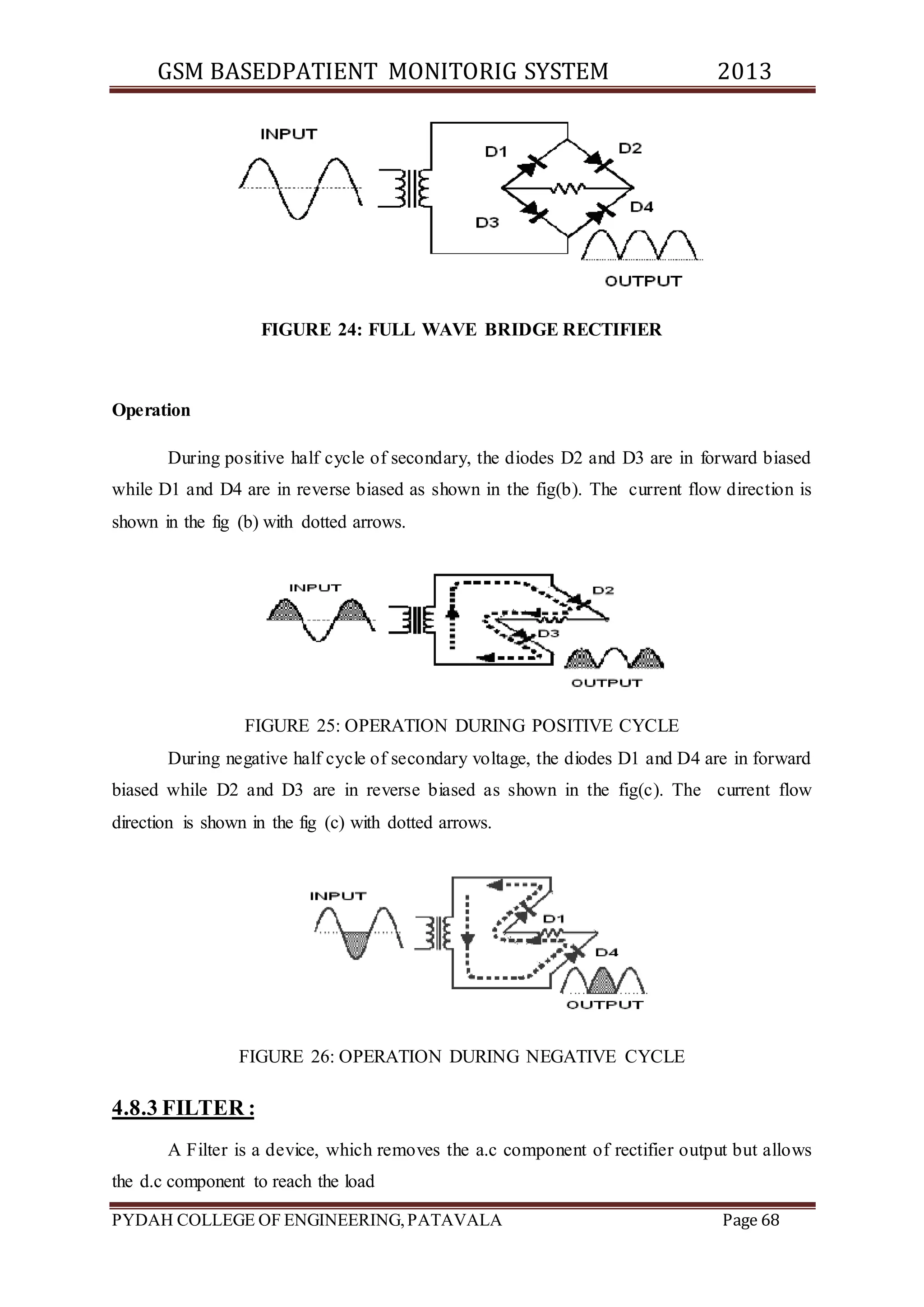 GSM BASEDPATIENT MONITORIG SYSTEM 2013 
FIGURE 24: FULL WAVE BRIDGE RECTIFIER 
Operation 
During positive half cycle of secondary, the diodes D2 and D3 are in forward biased 
while D1 and D4 are in reverse biased as shown in the fig(b). The current flow direction is 
shown in the fig (b) with dotted arrows. 
FIGURE 25: OPERATION DURING POSITIVE CYCLE 
During negative half cycle of secondary voltage, the diodes D1 and D4 are in forward 
biased while D2 and D3 are in reverse biased as shown in the fig(c). The current flow 
direction is shown in the fig (c) with dotted arrows. 
FIGURE 26: OPERATION DURING NEGATIVE CYCLE 
4.8.3 FILTER : 
A Filter is a device, which removes the a.c component of rectifier output but allows 
the d.c component to reach the load 
PYDAH COLLEGE OF ENGINEERING, PATAVALA Page 68 
 