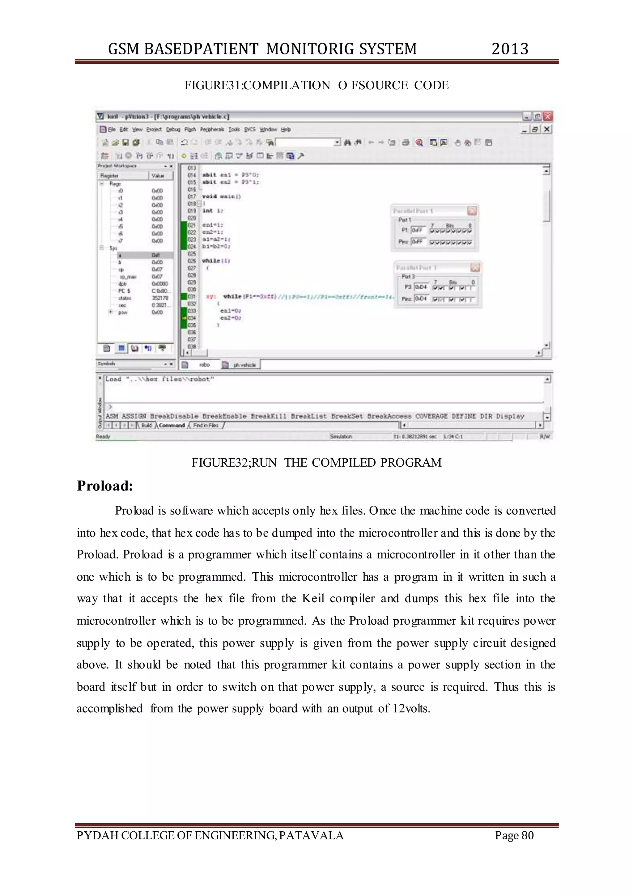 GSM BASEDPATIENT MONITORIG SYSTEM 2013 
FIGURE31:COMPILATION O FSOURCE CODE 
FIGURE32;RUN THE COMPILED PROGRAM 
Proload: 
Proload is software which accepts only hex files. Once the machine code is converted 
into hex code, that hex code has to be dumped into the microcontroller and this is done by the 
Proload. Proload is a programmer which itself contains a microcontroller in it other than the 
one which is to be programmed. This microcontroller has a program in it written in such a 
way that it accepts the hex file from the Keil compiler and dumps this hex file into the 
microcontroller which is to be programmed. As the Proload programmer kit requires power 
supply to be operated, this power supply is given from the power supply circuit designed 
above. It should be noted that this programmer kit contains a power supply section in the 
board itself but in order to switch on that power supply, a source is required. Thus this is 
accomplished from the power supply board with an output of 12volts. 
PYDAH COLLEGE OF ENGINEERING, PATAVALA Page 80 
 