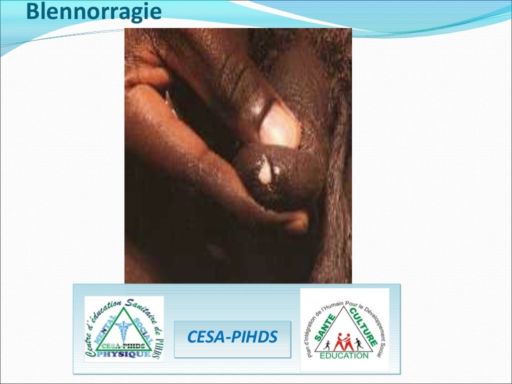 Document sensibilisation de