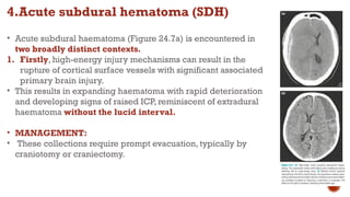 Head trauma and it's surgical managent in casualties | PPTX
