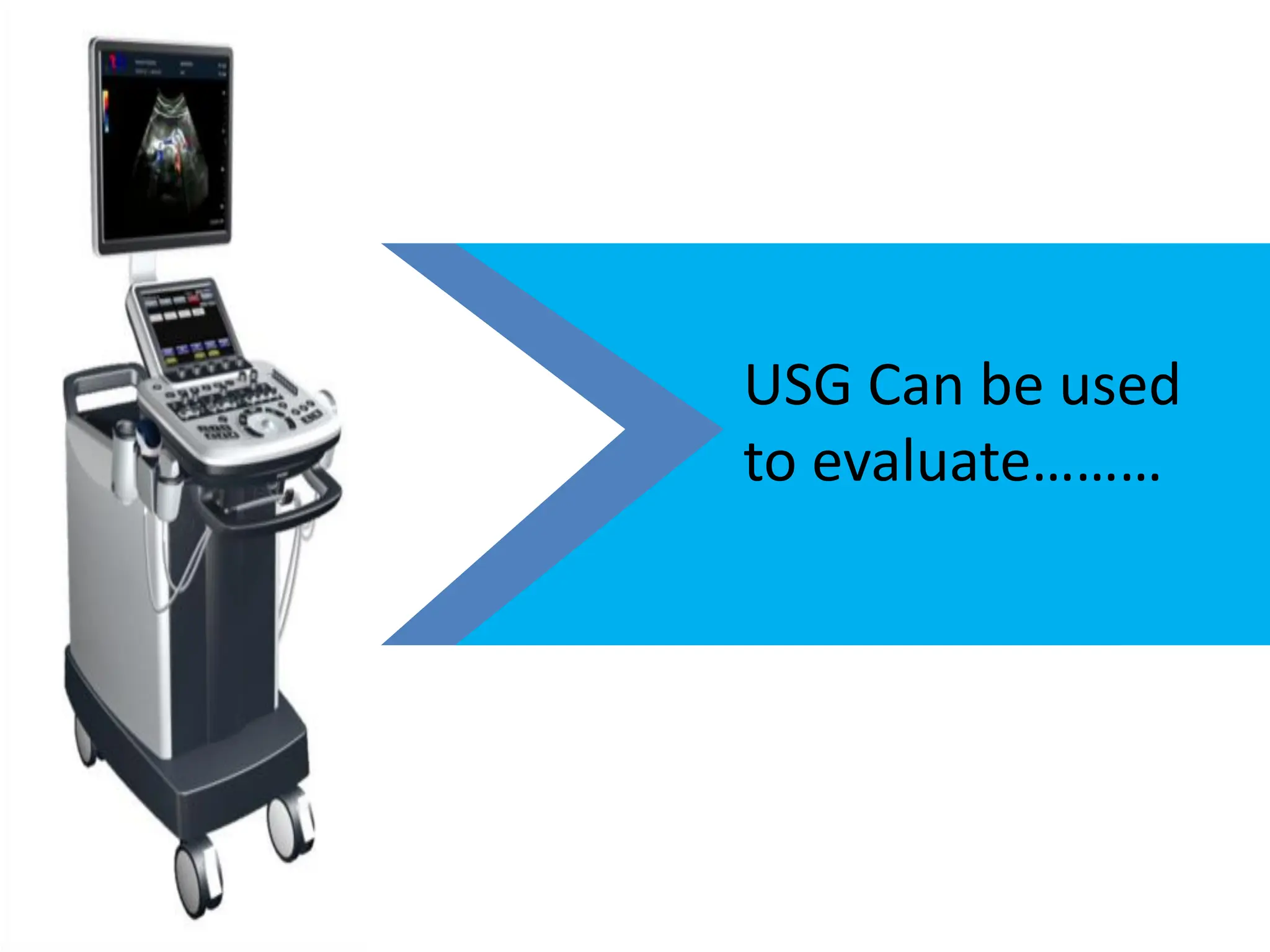 USG Can be used
to evaluate………
 