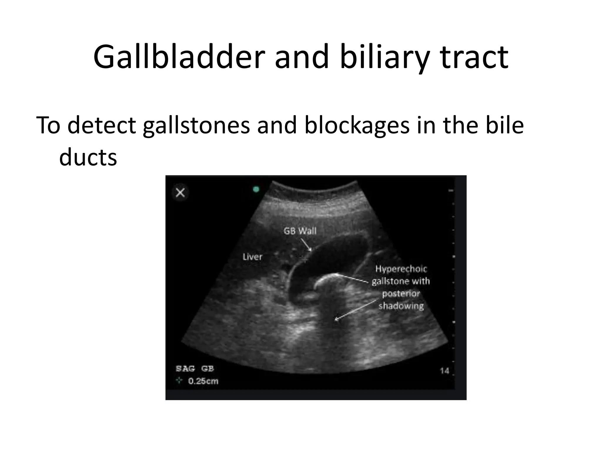 Gallbladder and biliary tract
To detect gallstones and blockages in the bile
ducts
 