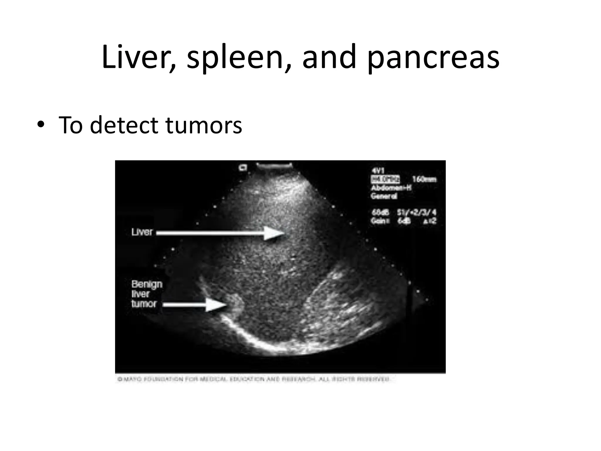 Liver, spleen, and pancreas
• To detect tumors
 