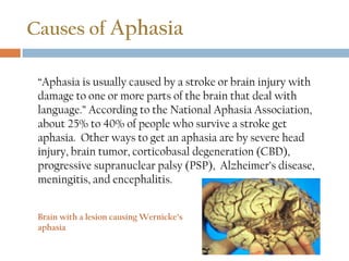 Causes of Aphasia
“Aphasia is usually caused by a stroke or brain injury with
damage to one or more parts of the brain that deal with
language.” According to the National Aphasia Association,
about 25% to 40% of people who survive a stroke get
aphasia. Other ways to get an aphasia are by severe head
injury, brain tumor, corticobasal degeneration (CBD),
progressive supranuclear palsy (PSP), Alzheimer’s disease,
meningitis, and encephalitis.
Brain with a lesion causing Wernicke’s
aphasia
 