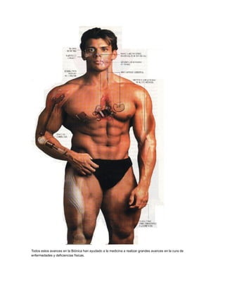 Todos estos avances en la Biónica han ayudado a la medicina a realizar grandes avances en la cura de
enfermedades y deficiencias físicas.

 